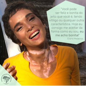 bahianoticia.com.br saude nessa segunda 25 foi comemorado dia mundial do vitiligo conscientize se whatsapp image 2018 06 25 at 22.58.09