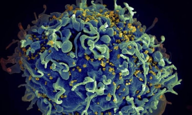 Cientistas anunciam 7º paciente curado do HIV 1 Cientistas anunciam 7º paciente curado do HIV