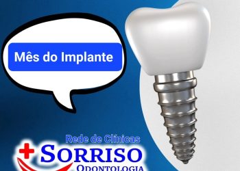 Candeias, Feira de Santana, Simões Filho e Salvador: Abril na Rede Mais Sorriso é o mês da implantes dentários