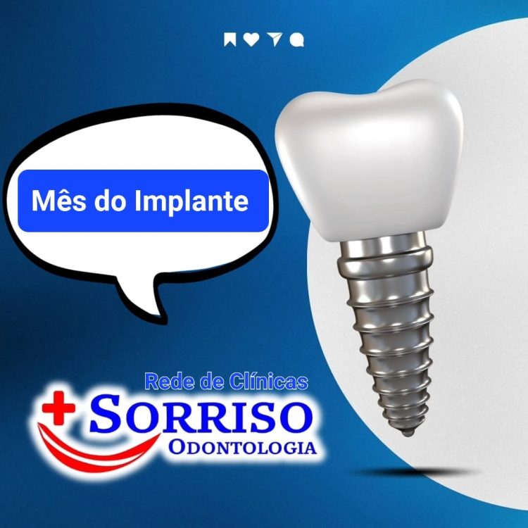 Candeias, Feira de Santana, Simões Filho e Salvador: Abril na Rede Mais Sorriso é o mês da implantes dentários